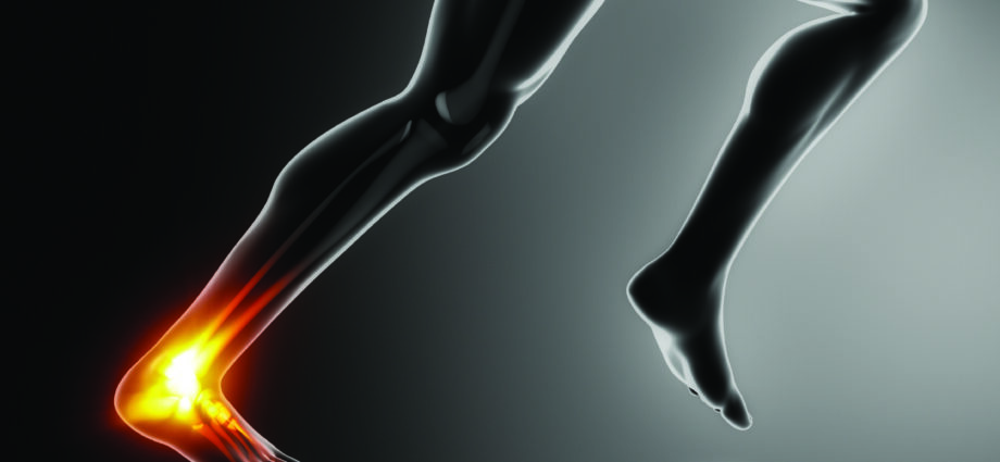 Sports ankle and achilles heel injury concept